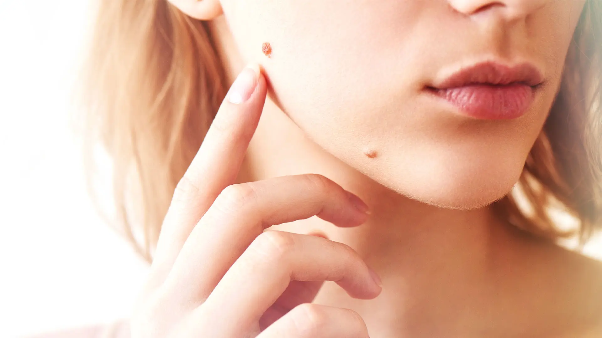 Common Skin Spot Treatments Boston & Wellesley